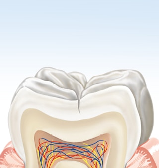 about-karies-tooth1-de.png about-karies-tooth1-de.png