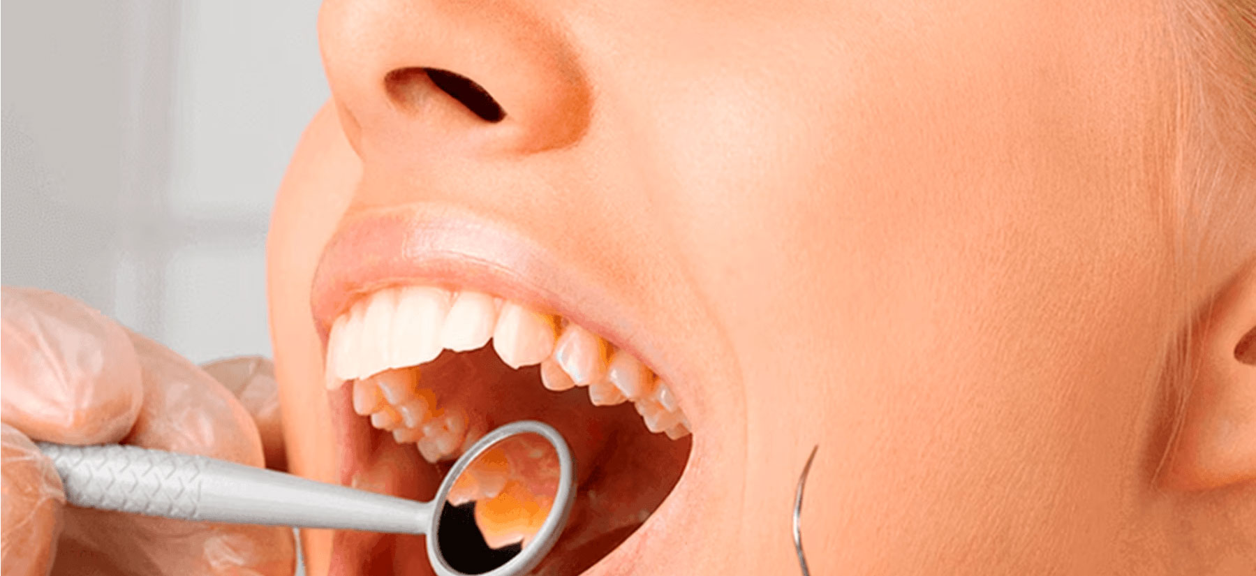 Eroziunea dentară: Ce alimente și băuturi pot avea impact asupra dinților?