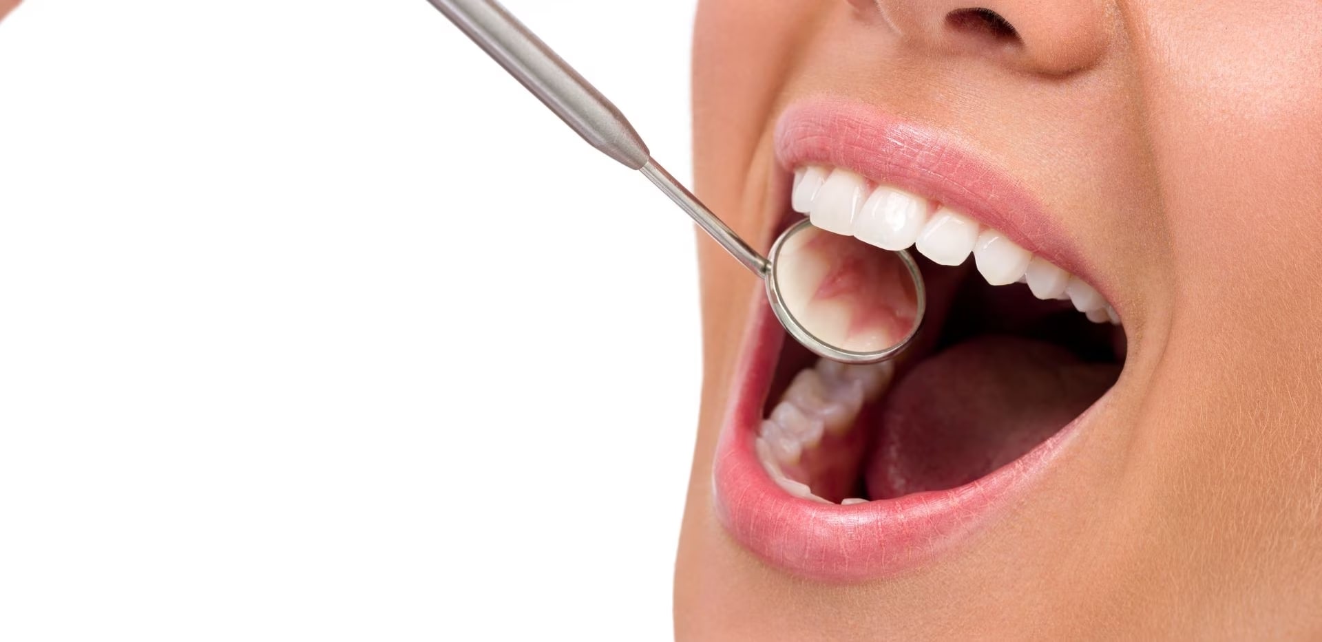 Cum să creșteți rezistența smalțului dentar?